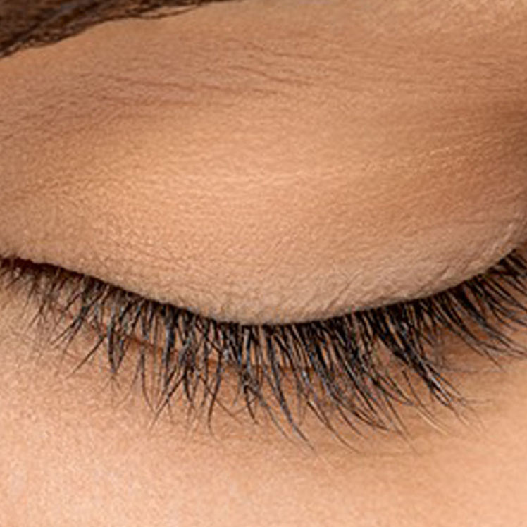 Lily before dermatica anti-ageing treatment