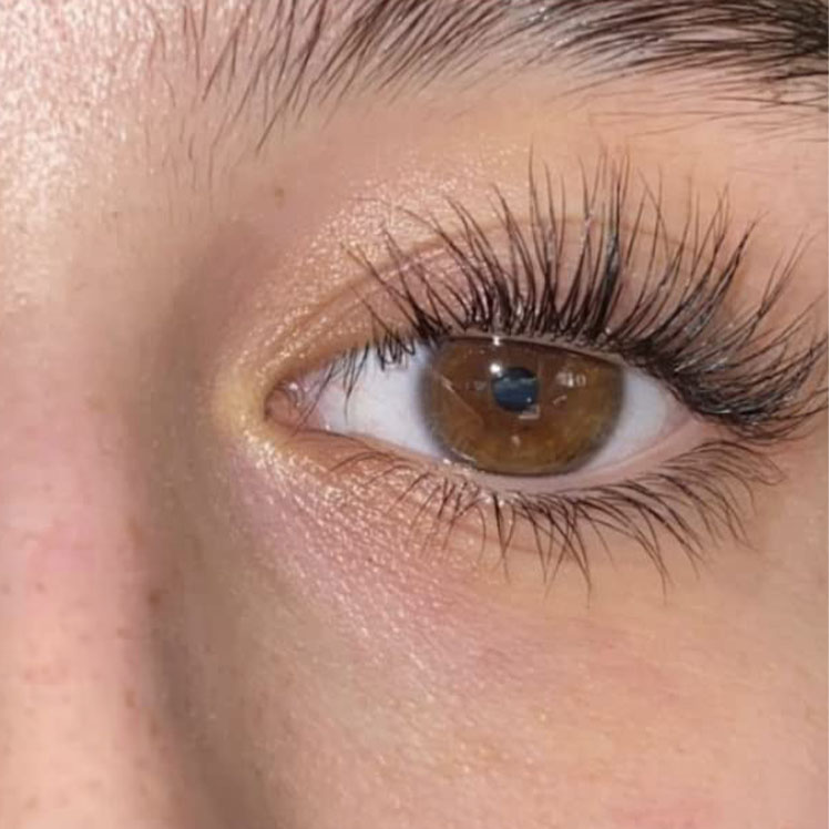 Lily after dermatica anti-ageing treatment