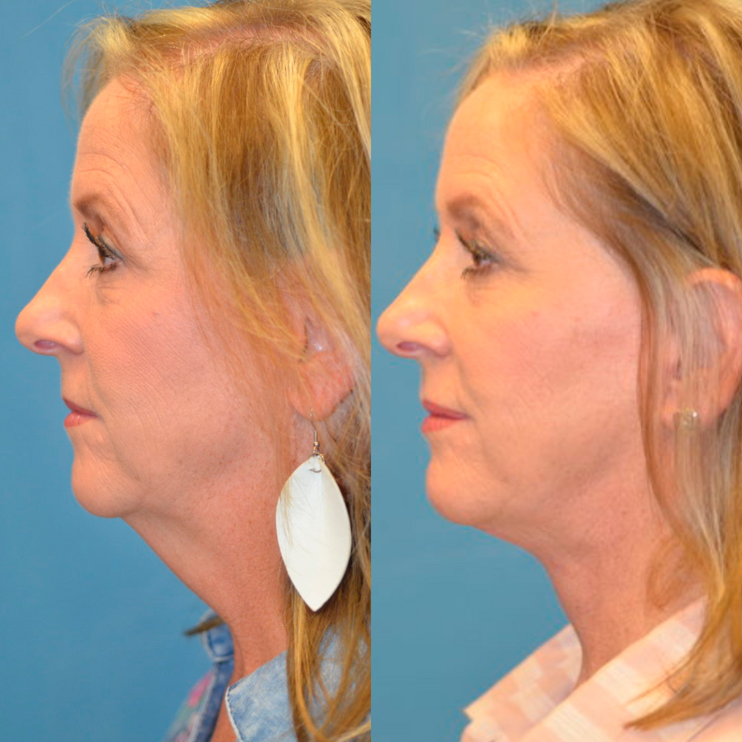 Ultimate Alpha Stack