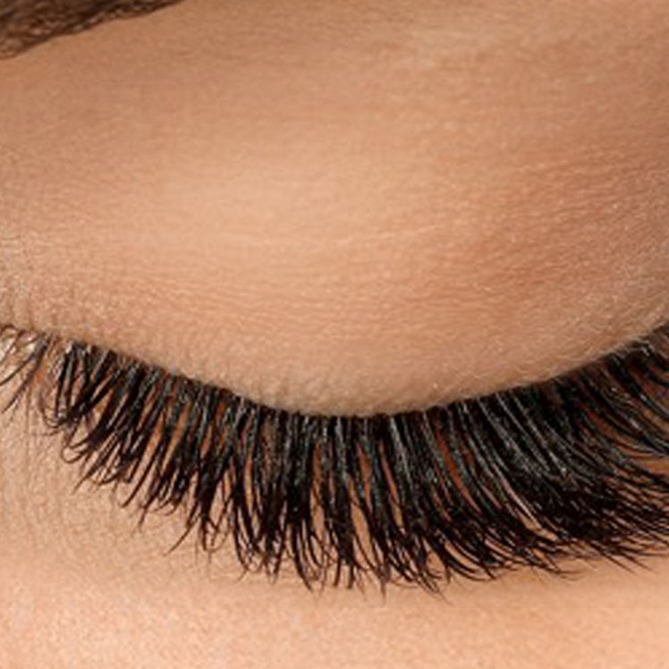 Lily after dermatica anti-ageing treatment